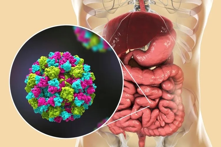 عدوى Norovirus تنتشر.. أعراض يجب الانتباه إليها